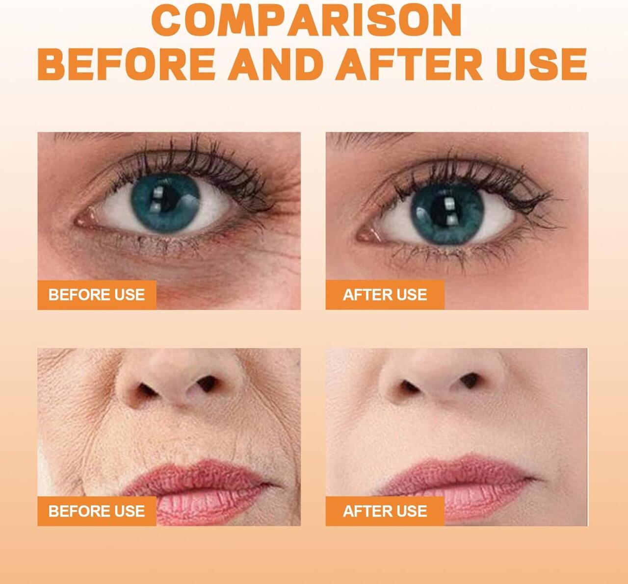 Parche de colageno mask Eelhoe